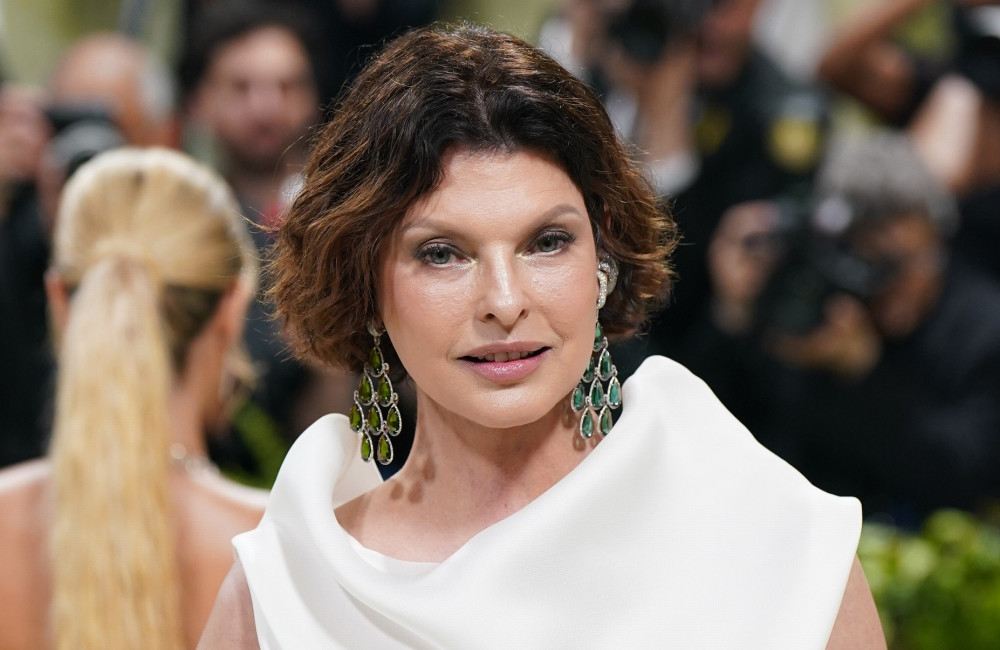 ‘Ancora non mi guardo allo specchio’: Linda Evangelista in terapia dopo l’operazione estetica andata male